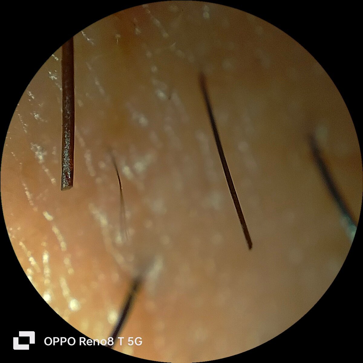 مواصفات و سعر oppo reno 8t 20 IMG20230220174301